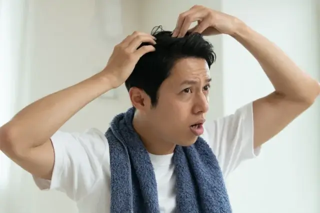 30代でAGA発症しやすい理由は？