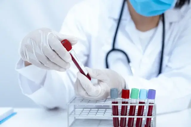 AGA治療の血液検査で調べる項目は？