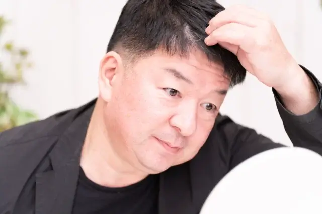 50代のAGA治療で効果はどこまで期待できる？