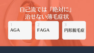 自分で治せる薄毛と治せない薄毛の違いは?