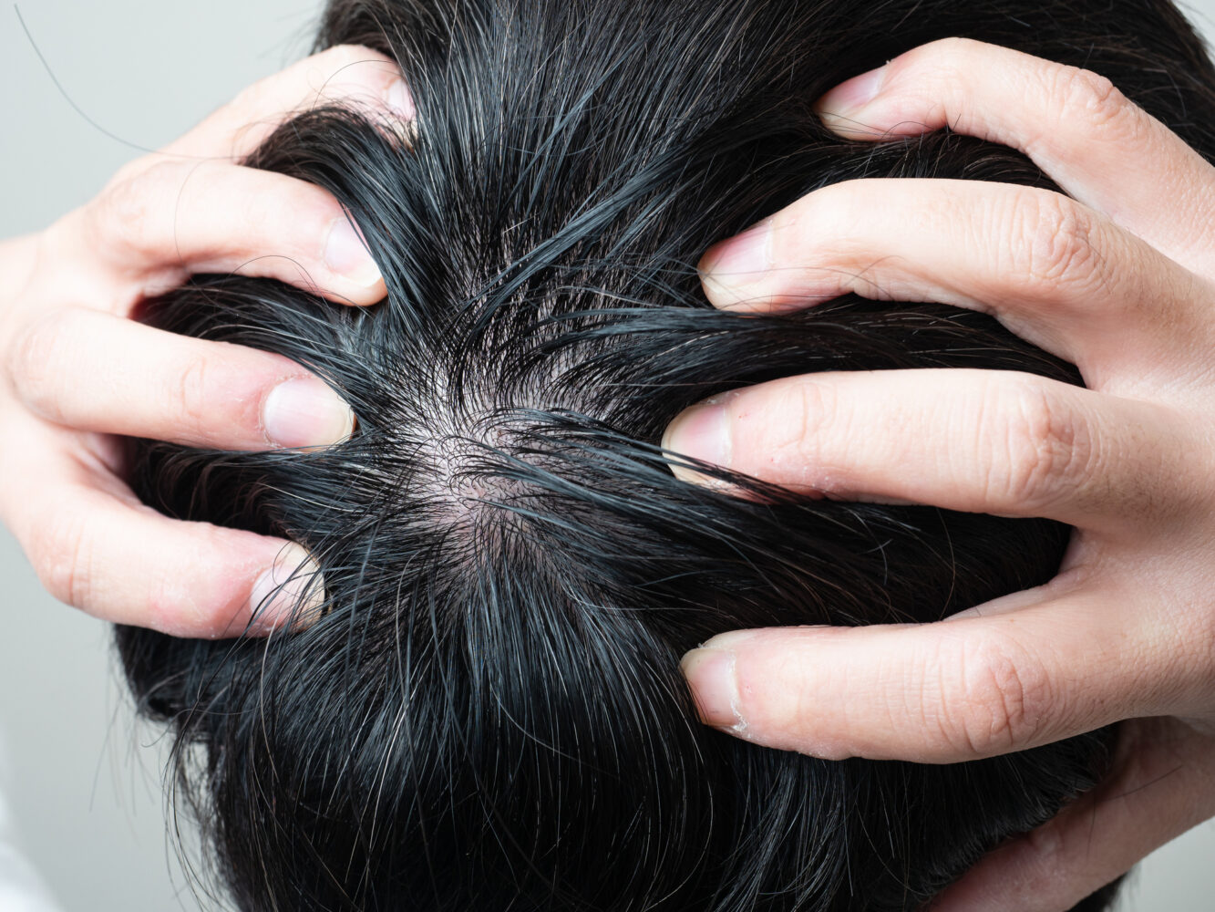 キープの費用はいくらですか?