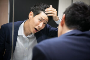 勘違い?生え際後退の正しいセルフチェック方法・改善対策を専門医が完全解説!