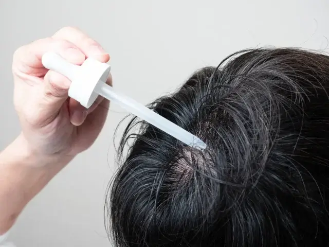 発毛剤の主要成分の作用と特徴