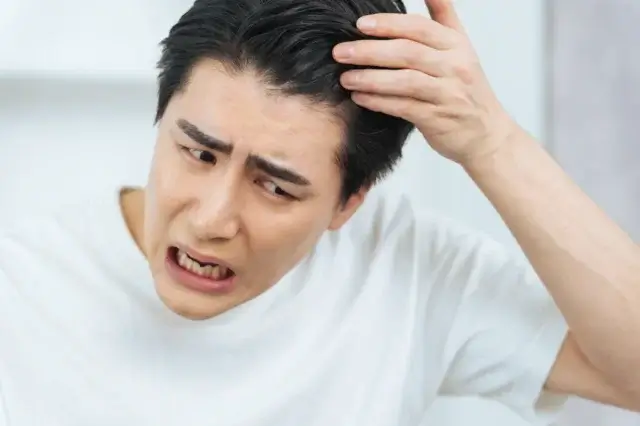 AGAのなりやすさは男性ホルモンの量ではなく体質で決まる