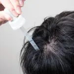ミノキシジルをやめてよかった！は本当？中止を決める前に医者に聞くべきポイントを徹底解説！