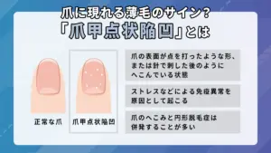 爪甲点状陥凹とは