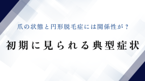 爪の状態と円形脱毛症には関係性が？初期に見られる典型症状