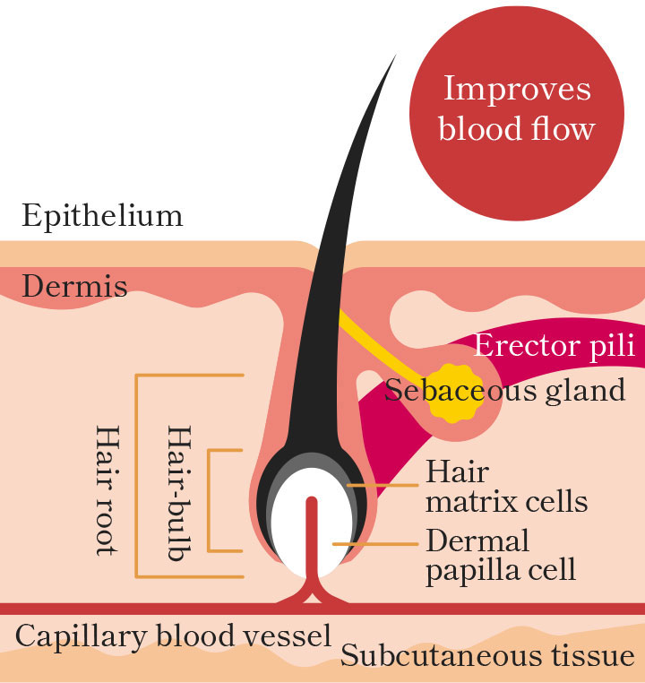 What causes baldness AGA