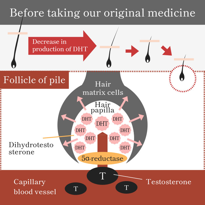 The Link Between Testosterone And Hair Loss In Men And Women  SkinKraft