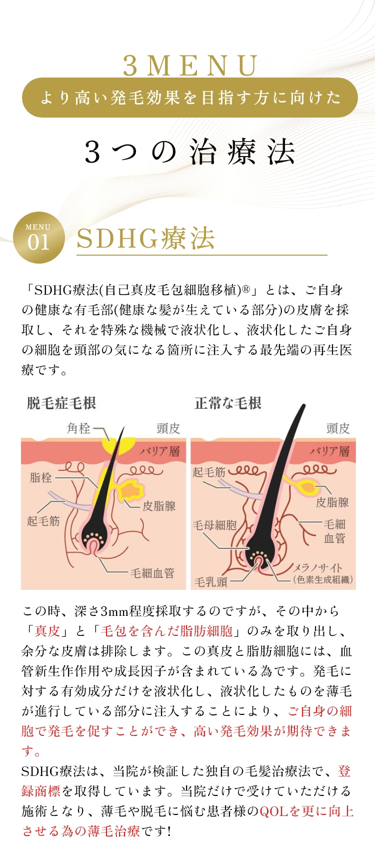 より高い発毛効果を目指す方に向けた3つの治療法