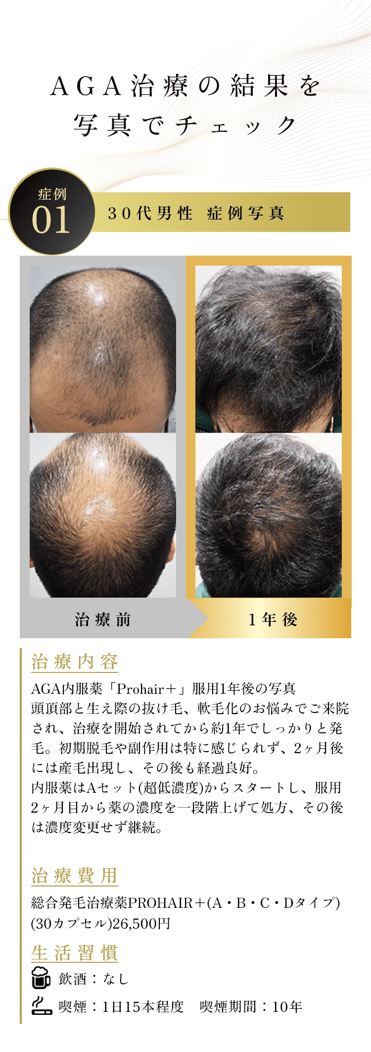AGA治療の結果を
写真でチェック