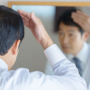 どうして薄毛になる？