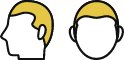 Ⅰ型