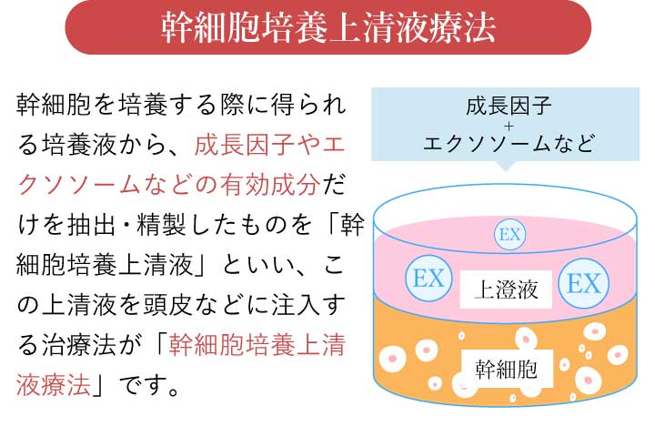 幹細胞培養上清液療法