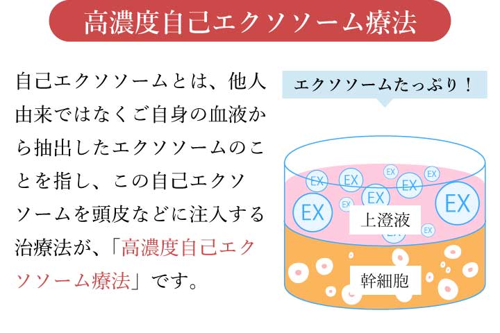 エクソソーム療法