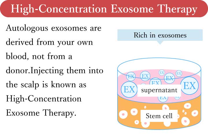 エクソソーム療法